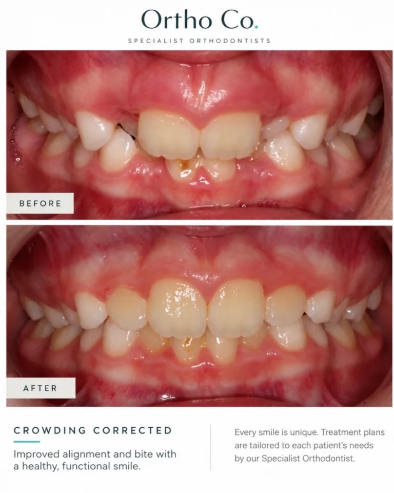 Instagram post from orthoco.sydney. This post is in position 1.
