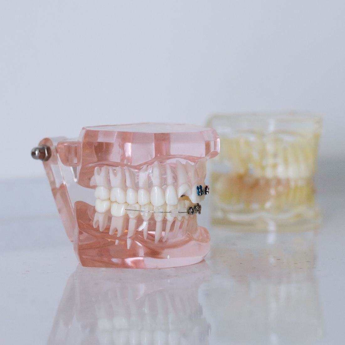 Dental arch models used to assess arch form