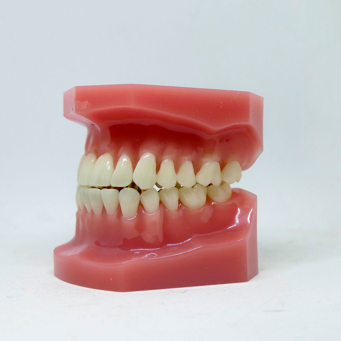 Model of the upper and lower dental arches